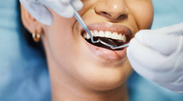 Best Emergency Dentist for Knocked-Out Tooth in Rancho Santa Margarita, CA